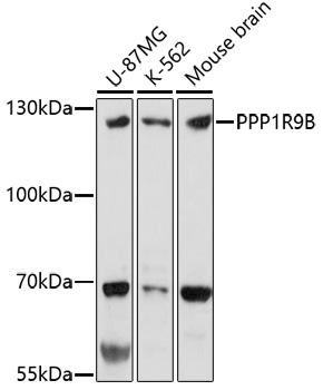 Western blot - PPP1R9B Polyclonal Antibody 