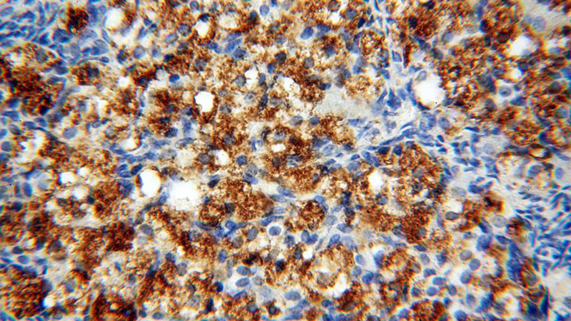Immunohistochemical of paraffin-embedded human ovary using Catalog No:114355(PYCR2 antibody) at dilution of 1:50 (under 40x lens)