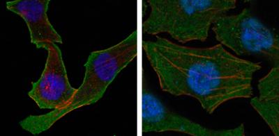 Confocal immunofluorescence analysis of SKBR-3 (left) and A549 (right) cells using Calreticulin mouse mAb (green). Red: Actin filaments have been labeled with DY-554 phalloidin. Blue: DRAQ5 fluorescent DNA dye.