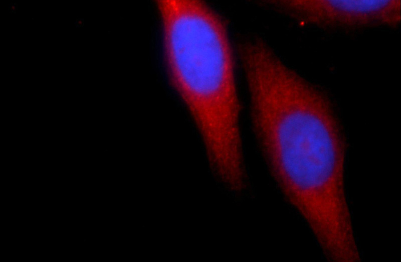 Immunofluorescent analysis of HepG2 cells using Catalog No:108017(AMZ1 Antibody) at dilution of 1:25 and Rhodamine-Goat anti-Rabbit IgG