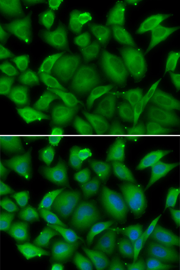 Immunofluorescence - DEFA1 Polyclonal Antibody 