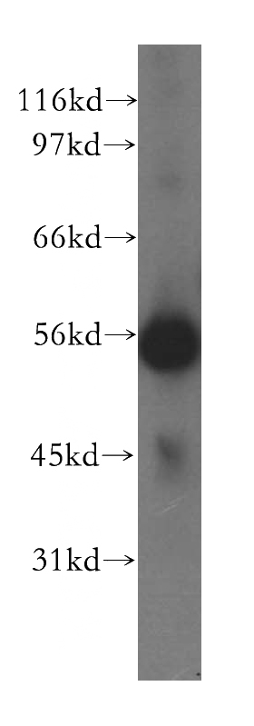 human liver tissue were subjected to SDS PAGE followed by western blot with Catalog No:115253(SKAP2 antibody) at dilution of 1:1500