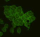 Fig2: ICC image of CD79a antibody stained F9 cells. The secondary antibody (green) was goat anti-rabbit IgG (H+L) FITC conjugated.