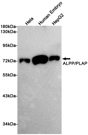 Western blot detection of ALPP/PLAP in Hela,Human Embryo,HepG2 cell lysates using ALPP/PLAP (3C11) Mouse mAb(1:1000 diluted).Predicted band size:58KDa.Observed band size:70KDa.