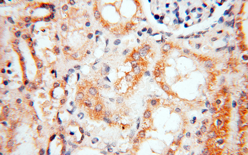 Immunohistochemical of paraffin-embedded human kidney using Catalog No:108262(ARHGAP18 antibody) at dilution of 1:25 (under 40x lens)