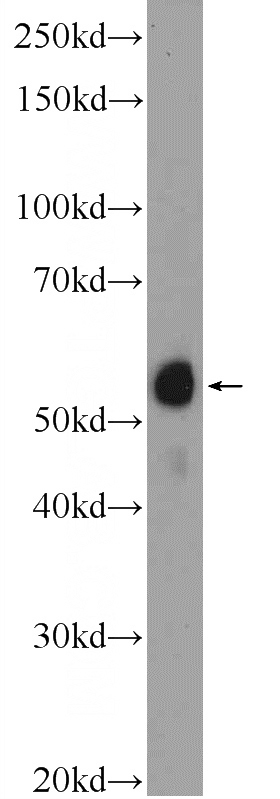 Jurkat cells were subjected to SDS PAGE followed by western blot with Catalog No:107733(ACD Antibody) at dilution of 1:1500