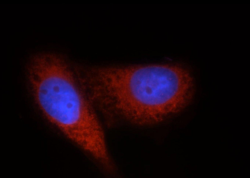 Immunofluorescent analysis of HepG2 cells, using DDX20 antibody Catalog No:109820 at 1:50 dilution and Rhodamine-labeled goat anti-rabbit IgG (red). Blue pseudocolor = DAPI (fluorescent DNA dye).