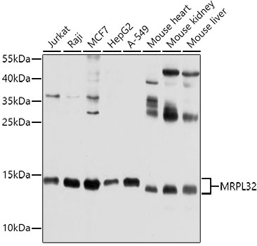 Western blot - MRPL32 Polyclonal Antibody 