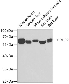 Western blot - CRHR2 Polyclonal Antibody 