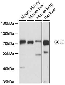 Western blot - GCLC Polyclonal Antibody 