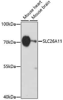 Western blot - SLC26A11 Polyclonal Antibody 