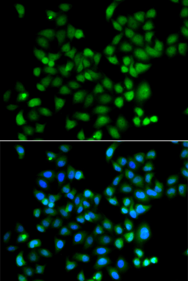 Immunofluorescence - ZSCAN26 Polyclonal Antibody 