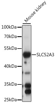 Western blot - SLC52A3 Polyclonal Antibody 