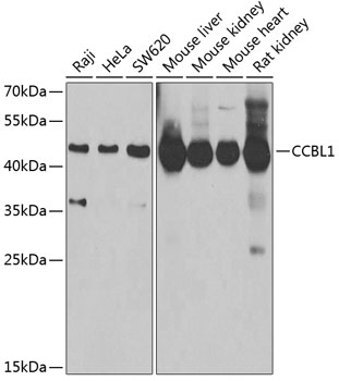 Western blot - CCBL1 Polyclonal Antibody 