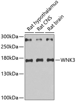 Western blot - WNK3 Polyclonal Antibody 