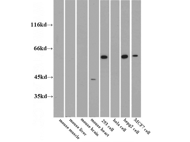 WB results of Catalog No:113861(PKM2 antibody) at dilution of 1:1500.