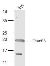 Fig1: Sample:; Eye (Mouse) Lysate at 40 ug; Primary: Anti-C1orf86 at 1/300 dilution; Secondary: IRDye800CW Goat Anti-Rabbit IgG at 1/20000 dilution; Predicted band size: 20 kD; Observed band size: 20 kD