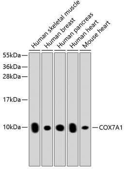 Western blot - COX7A1 Polyclonal Antibody 
