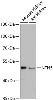 Western blot - NTN5 Polyclonal Antibody 