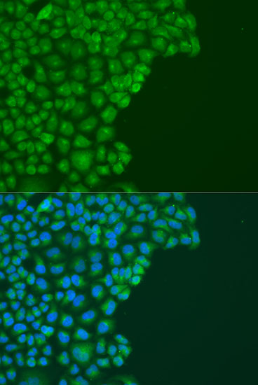 Immunofluorescence - DAPK2 Polyclonal Antibody 