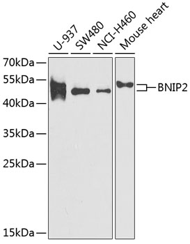 Western blot - BNIP2 Polyclonal Antibody 