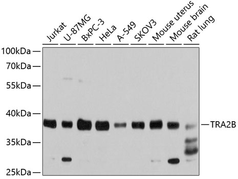 Western blot - TRA2B Polyclonal Antibody 