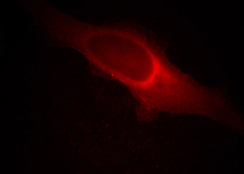 Immunofluorescent analysis of Hela cells, using MMS19 antibody Catalog No: at 1:50 dilution and Rhodamine-labeled goat anti-mouse IgG (red).
