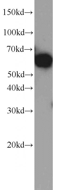 Jurkat cells were subjected to SDS PAGE followed by western blot with Catalog No:113496(PAK1 antibody) at dilution of 1:1000