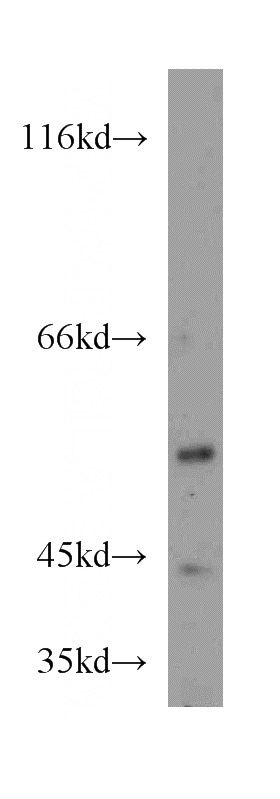 HeLa cells were subjected to SDS PAGE followed by western blot with Catalog No:115485(SNX7 antibody) at dilution of 1:300