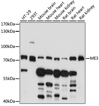 Western blot - ME3 Polyclonal Antibody 