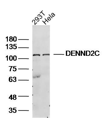 Fig1: Sample:; 293T Cell (Human) Lysate at 30 ug; Hela Cell (Human) Lysate at 30 ug; Primary: Anti- DENND2C at 1/300 dilution; Secondary: IRDye800CW Goat Anti-Rabbit IgG at 1/20000 dilution; Predicted band size: 107kD; Observed band size: 107kD