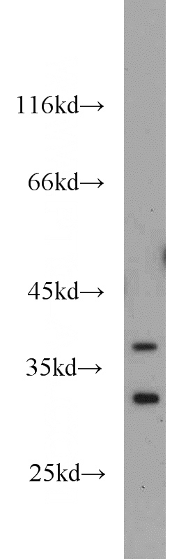 mouse brain tissue were subjected to SDS PAGE followed by western blot with Catalog No:116847(WBP2 antibody) at dilution of 1:1000