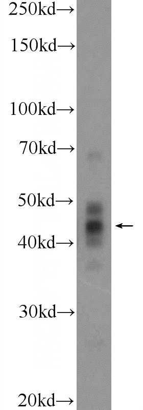 SKOV-3 cells were subjected to SDS PAGE followed by western blot with Catalog No:116191(TMEM54 Antibody) at dilution of 1:300
