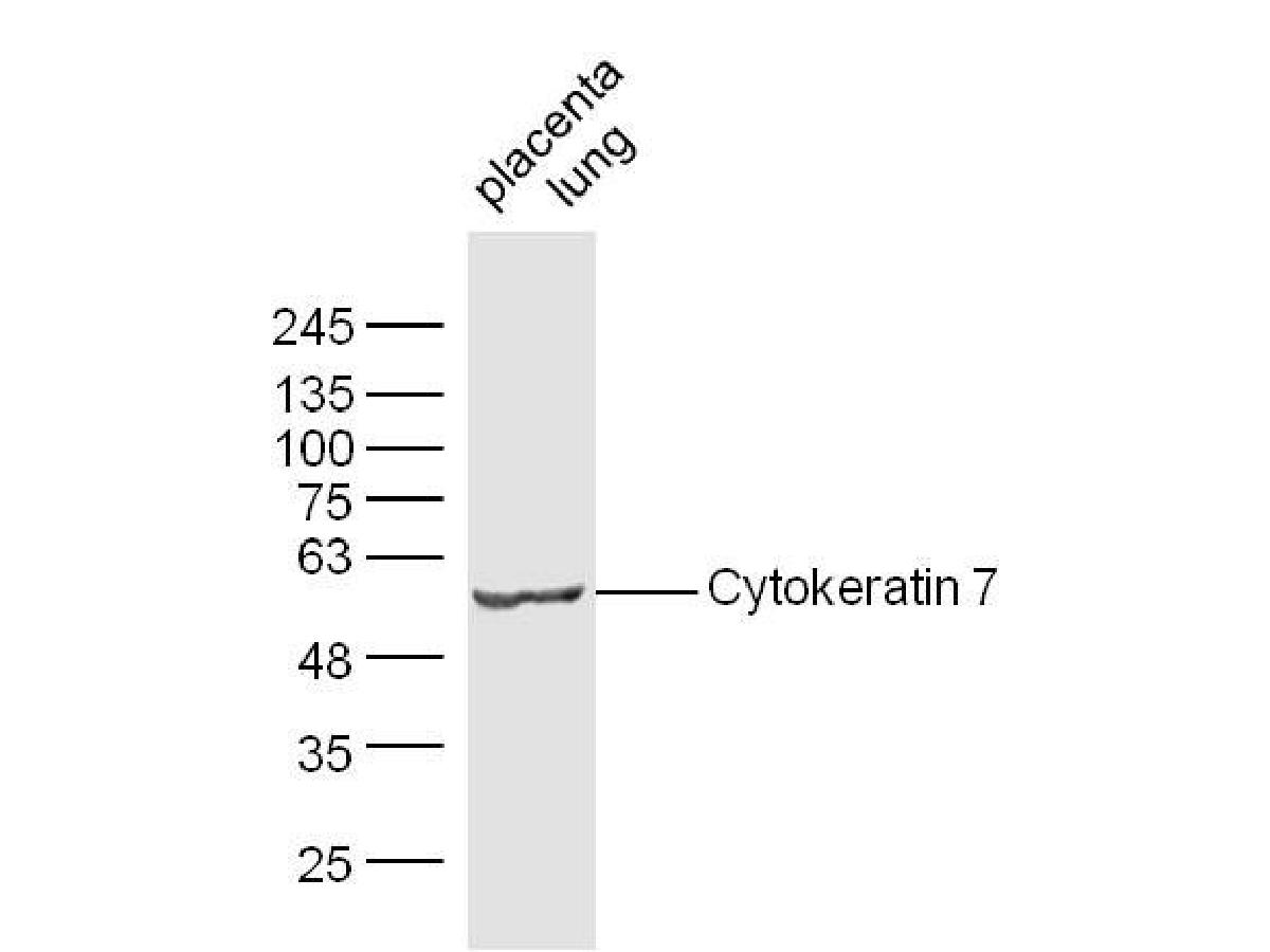 Fig4: Sample:; Placenta (Mouse) Lysate at 30 ug; Lung (Mouse) Lysate at 30 ug; Primary: Anti-Cytokeratin 7 at 1/300 dilution; Secondary: IRDye800CW Goat Anti-Mouse IgG at 1/10000 dilution; Predicted band size: 54 kD; Observed band size: 54 kD