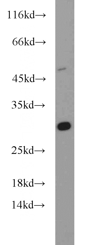A431 cells were subjected to SDS PAGE followed by western blot with Catalog No:109890(DENR antibody) at dilution of 1:1000