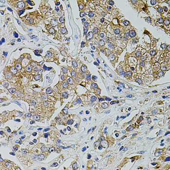 Immunohistochemistry - TRPA1 Polyclonal Antibody 