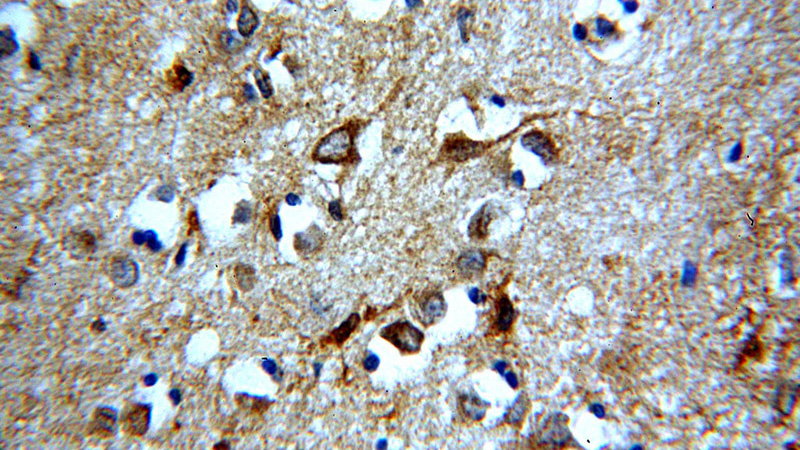 Immunohistochemical of paraffin-embedded human brain using Catalog No:108243(ARF1 antibody) at dilution of 1:100 (under 40x lens)