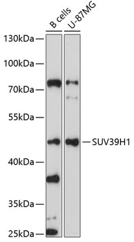 Western blot - SUV39H1 Polyclonal Antibody 