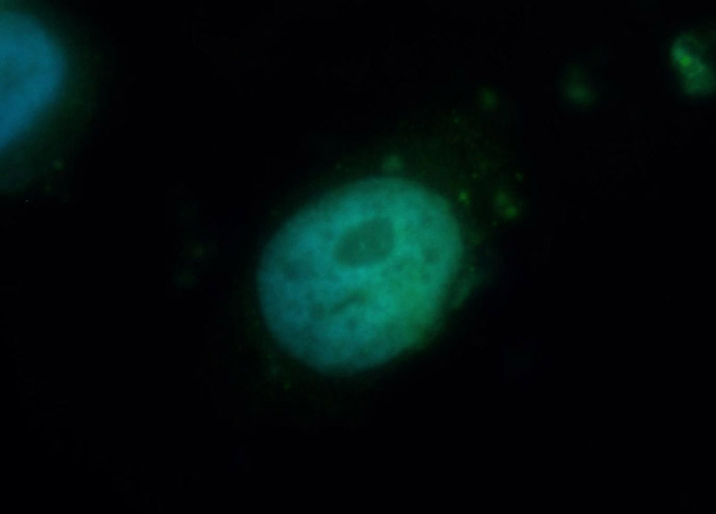 Immunofluorescent analysis of Hela cells, using CDC73 antibody Catalog No:111466 at 1:50 dilution and FITC-labeled donkey anti-rabbit IgG (green). Blue pseudocolor = DAPI (fluorescent DNA dye).