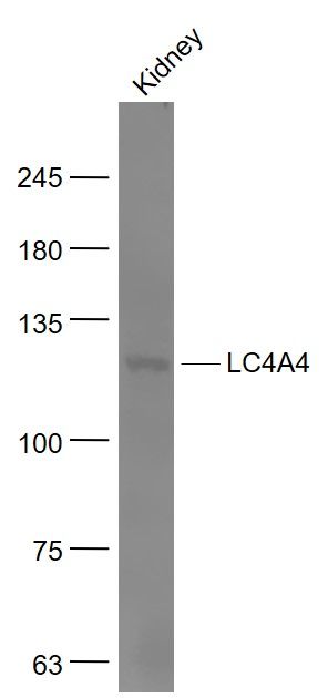 Fig1: Sample:; Kidney (Mouse) Lysate at 40 ug; Primary: Anti- SLC4A4 at 1/1000 dilution; Secondary: IRDye800CW Goat Anti-Rabbit IgG at 1/20000 dilution; Predicted band size: 116 kD; Observed band size: 116 kD