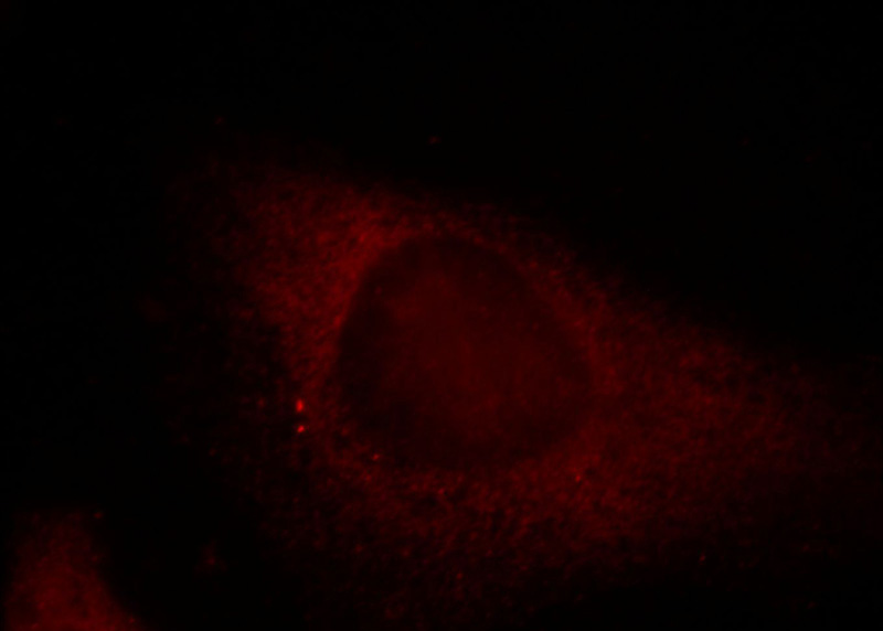 Immunofluorescent analysis of Hela cells, using SRGAP3 antibody Catalog No:115588 at 1:25 dilution and Rhodamine-labeled goat anti-rabbit IgG (red).