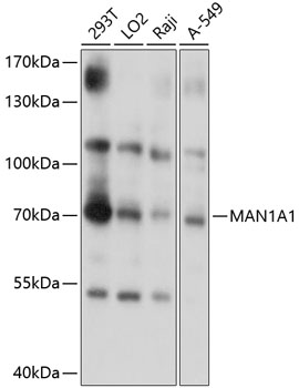 Western blot - MAN1A1 Polyclonal Antibody 