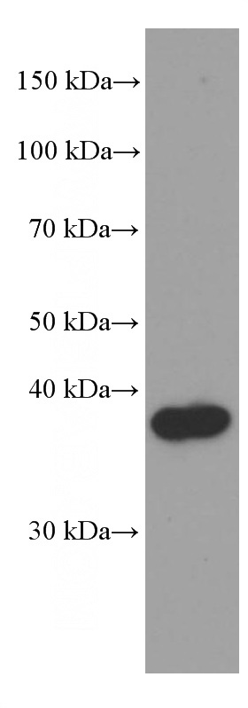 rat brain tissue were subjected to SDS PAGE followed by western blot with Catalog No:107585(SFRP2 Antibody) at dilution of 1:2000