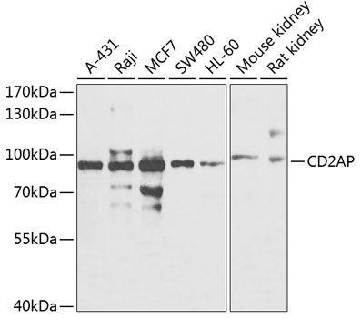 Western blot - CD2AP Polyclonal Antibody 