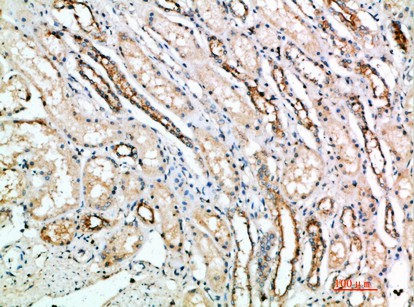 Fig1:; Immunohistochemical analysis of paraffin-embedded human-kidney, antibody was diluted at 1:200