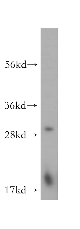 human kidney tissue were subjected to SDS PAGE followed by western blot with Catalog No:113464(OBFC2B antibody) at dilution of 1:200