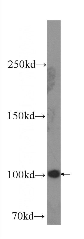 HeLa cells were subjected to SDS PAGE followed by western blot with Catalog No:107598(SND1 Antibody) at dilution of 1:1000