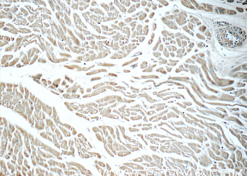 Immunohistochemistry of paraffin-embedded human heart tissue slide using Catalog No:111723(humanin Antibody) at dilution of 1:50 (under 10x lens)