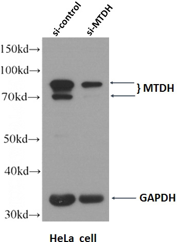 WB result of AEG-1/MTDH antibody (Catalog No:107899, 1:2000) with si-Control and si-MTDH transfected A549 cells.