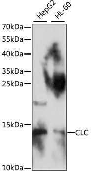 Western blot - CLC Polyclonal Antibody 